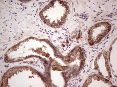 Immunohistochemistry: Angiopoietin-2 Antibody (OTI3H7) [NBP2-46520]
