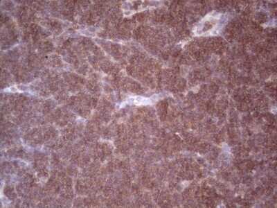 Immunohistochemistry: Angiopoietin-2 Antibody (OTI3H7) [NBP2-46520]