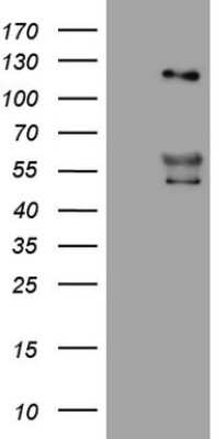 Western Blot: Angiopoietin-2 Antibody (OTI3H7) [NBP2-46520]