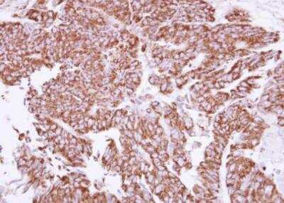 Immunohistochemistry-Paraffin: Angiopoietin-2 Antibody [NBP2-15385]