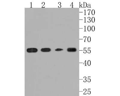 Western Blot: Angiopoietin-2 Antibody (JM71-34) [NBP2-67154]