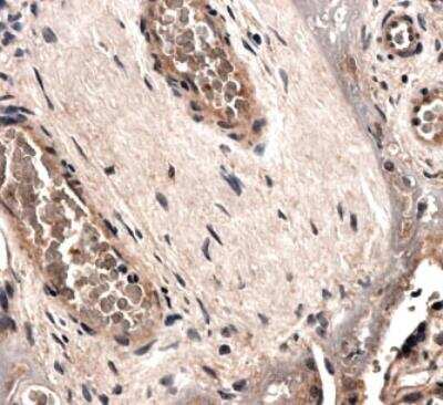 Immunohistochemistry: Angiopoietin-2 Antibody (MM0020-1F29) - Azide and BSA Free [NB110-85467]