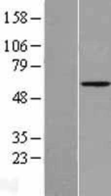 Western Blot: Angiopoietin-2 Overexpression Lysate [NBL1-07522]