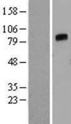 Western Blot: Angiopoietin-4 Overexpression Lysate [NBP2-07100]