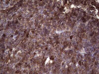 Immunohistochemistry: Angiopoietin-like Protein 1/ANGPTL1 Antibody (OTI1B2) [NBP2-46521]