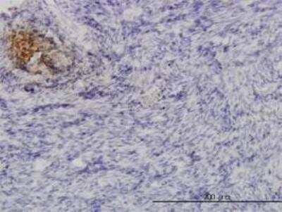 Immunohistochemistry-Paraffin: Angiopoietin-like Protein 1/ANGPTL1 Antibody (3A5) [H00009068-M03]