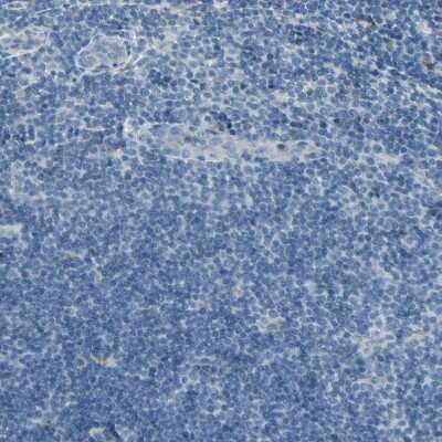 Immunohistochemistry-Paraffin: Angiopoietin-like Protein 1/ANGPTL1 Antibody [NBP1-89088]