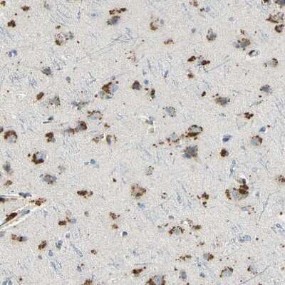 Immunohistochemistry-Paraffin: Angiopoietin-like Protein 1/ANGPTL1 Antibody [NBP1-89088]