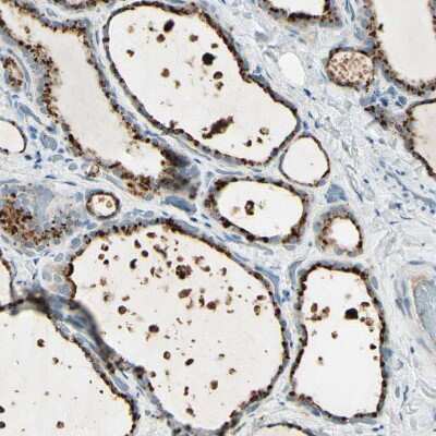 Immunohistochemistry-Paraffin: Angiopoietin-like Protein 1/ANGPTL1 Antibody [NBP1-89088]