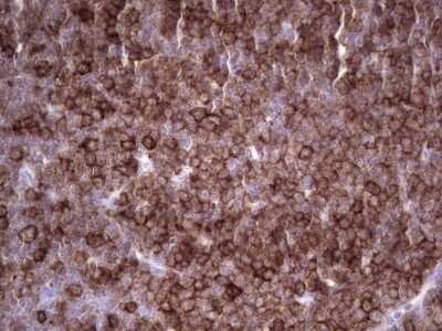 Immunohistochemistry: Angiopoietin-like Protein 1/ANGPTL1 Antibody (OTI1B2) - Azide and BSA Free [NBP2-71414]