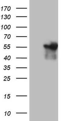 Western Blot: Angiopoietin-like Protein 1/ANGPTL1 Antibody (OTI1B2)Azide and BSA Free [NBP2-71414]