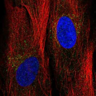 Immunocytochemistry/ Immunofluorescence: Angiopoietin-like Protein 2/ANGPTL2 Antibody [NBP1-88998]