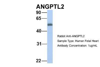 Western Blot: Angiopoietin-like Protein 2/ANGPTL2 Antibody [NBP1-79557]
