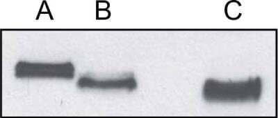 Western Blot: Angiopoietin-like Protein 2/ANGPTL2 Antibody [NBP1-79557]