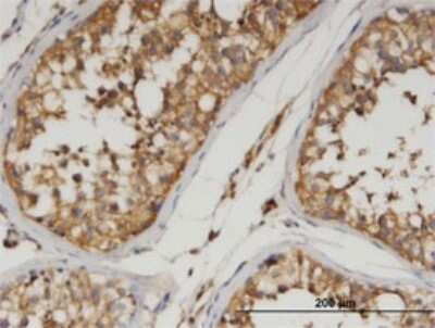 Immunohistochemistry-Paraffin: Angiopoietin-like Protein 3/ANGPTL3 Antibody (3B7) [H00027329-M01]