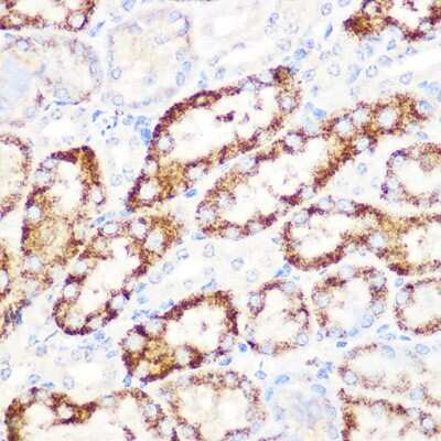 Immunohistochemistry-Paraffin: Angiopoietin-like Protein 3/ANGPTL3 Antibody (4W9A7) [NBP3-16596]
