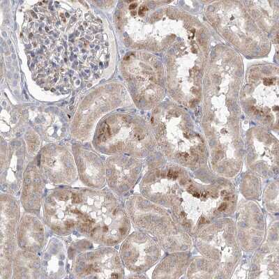 Immunohistochemistry-Paraffin: Angiopoietin-like Protein 3/ANGPTL3 Antibody [NBP1-89087]