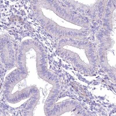 Immunohistochemistry-Paraffin: Angiopoietin-like Protein 3/ANGPTL3 Antibody [NBP1-89087]