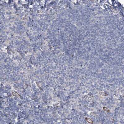 Immunohistochemistry-Paraffin: Angiopoietin-like Protein 3/ANGPTL3 Antibody [NBP1-89087]