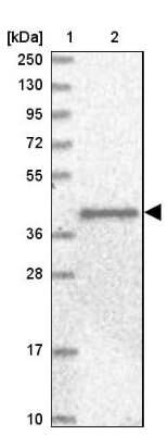 Western Blot: Angiopoietin-like Protein 3/ANGPTL3 Antibody [NBP1-89087]