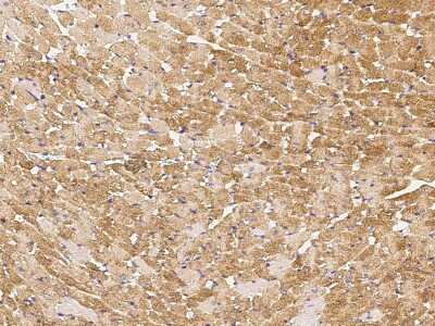 Immunohistochemistry-Paraffin: Angiopoietin-like Protein 4/ANGPTL4 Antibody [NBP2-98267]