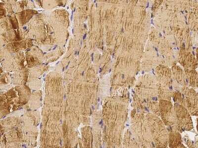 Immunohistochemistry-Paraffin: Angiopoietin-like Protein 4/ANGPTL4 Antibody [NBP2-98267]