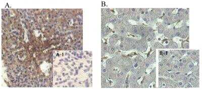 Immunohistochemistry-Paraffin: Angiopoietin-like Protein 4/ANGPTL4 Antibody (Kairos-1) - Azide and BSA Free [NBP2-80039]