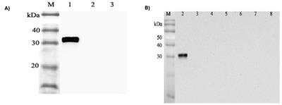 Western Blot: Angiopoietin-like Protein 4/ANGPTL4 Antibody (Kairos-1)Azide and BSA Free [NBP2-80039]