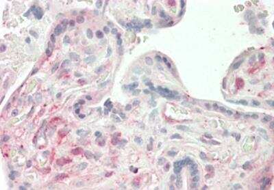 Immunohistochemistry-Paraffin: Angiopoietin-like Protein 4/ANGPTL4 Antibody (Kairos4-397G) - Azide and BSA Free [NBP2-80042]