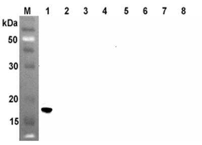 Western Blot: Angiopoietin-like Protein 4/ANGPTL4 Antibody (Kairos4-397G)Azide and BSA Free [NBP2-80042]