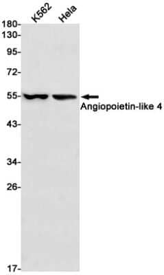 Western Blot: Angiopoietin-like Protein 4/ANGPTL4 Antibody (S04-1B5) [NBP3-14995]