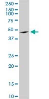 Western Blot: Angiopoietin-like Protein 4/ANGPTL4 Antibody [H00051129-B01P]