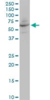 Western Blot: Angiopoietin-like Protein 4/ANGPTL4 Antibody [H00051129-B01P]