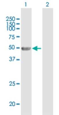 Western Blot: Angiopoietin-like Protein 4/ANGPTL4 Antibody [H00051129-B01P]