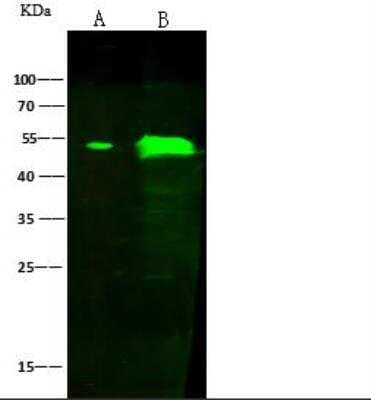 Western Blot: Angiopoietin-like Protein 4/ANGPTL4 Antibody [NBP2-98267]