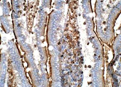 Immunohistochemistry-Paraffin: Angiopoietin-like Protein 5/ANGPTL5 Antibody [NBP3-12379]