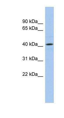 Western Blot: Angiopoietin-like Protein 5/ANGPTL5 Antibody [NBP1-57966]