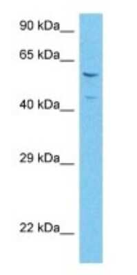 Western Blot: Angiopoietin-like Protein 6/ANGPTL6 Antibody [NBP3-10663]