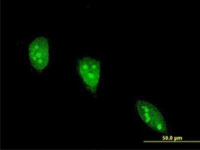Immunocytochemistry/ Immunofluorescence: Angiopoietin-like Protein 7/ANGPTL7 Antibody (2C6) [H00010218-M04-100ug]