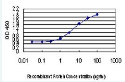 ELISA: Angiopoietin-like Protein 7/ANGPTL7 Antibody (2C7) [H00010218-M03-100ug]