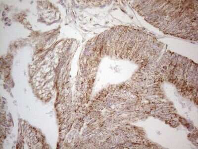 Immunohistochemistry: Angiopoietin-like protein 8/Betatrophin Antibody (OTI1B12) [NBP2-46596]