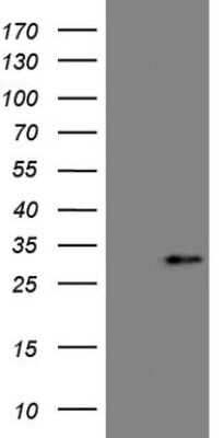 Western Blot: Angiopoietin-like protein 8/Betatrophin Antibody (OTI1B12) [NBP2-46596]