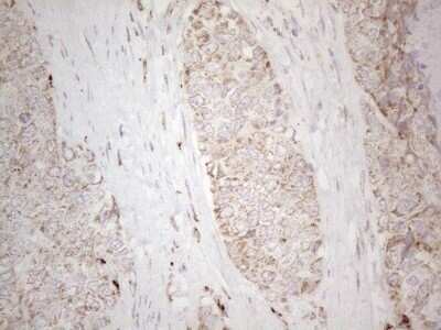 Immunohistochemistry: Angiopoietin-like protein 8/Betatrophin Antibody (OTI1B12) - Azide and BSA Free [NBP2-72046]