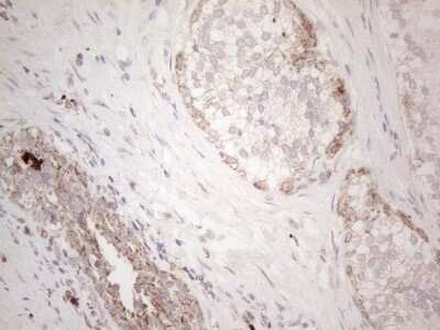 Immunohistochemistry: Angiopoietin-like protein 8/Betatrophin Antibody (OTI1B12) - Azide and BSA Free [NBP2-72046]