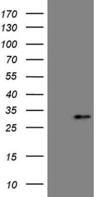 Western Blot: Angiopoietin-like protein 8/Betatrophin Antibody (OTI1B12)Azide and BSA Free [NBP2-72046]