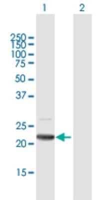 Western Blot: Angiopoietin-like protein 8/Betatrophin Antibody [H00055908-B01P]