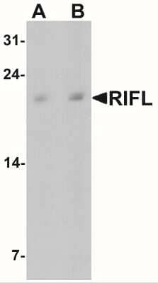 Western Blot: Angiopoietin-like protein 8/Betatrophin AntibodyBSA Free [NBP2-41247]