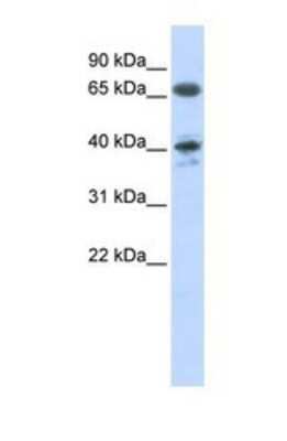 Western Blot: AGTR-1 Antibody [NBP1-59006]