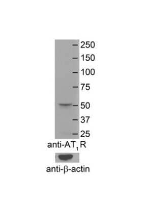 Western Blot: AGTR-1 Antibody [NBP1-59006]