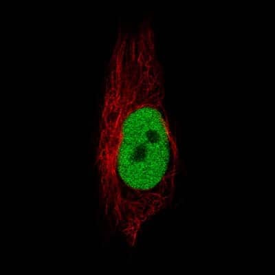 Immunocytochemistry/ Immunofluorescence: Anillin Antibody (CL0301) [NBP2-52907]